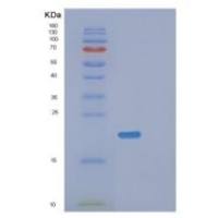 人氨基N-乙酰转移酶1重组蛋白