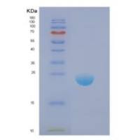 人DIRAS1重组蛋白