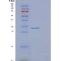 人DCUN1D1重组蛋白