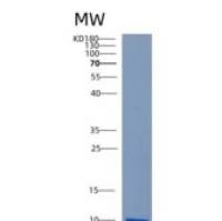 小鼠Cxcl12重组蛋白