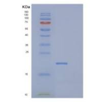 人DCTPP1重组蛋白