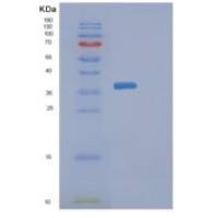 人DIMT1重组蛋白