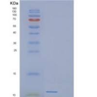 人DEFB116重组蛋白