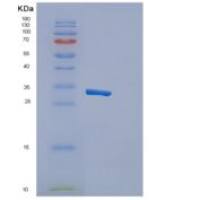 人细胞毒性和调节性T细胞分子蛋白质重组蛋白
