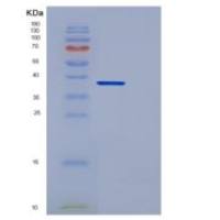 人核心蛋白聚糖(DCN)重组蛋白