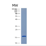 人半胱氨酸蛋白酶抑制剂4(CST4)重组蛋白