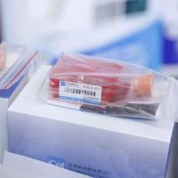 KYSE-450、KYSE-450细胞、KYSE450细胞、KYSE450、人食管鳞状细胞癌/STR鉴定