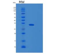 人DDAH1重组蛋白