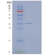 人DCUN1D4重组蛋白