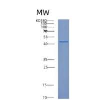 人CUEDC1重组蛋白