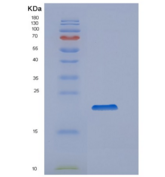 人亲环素B(Cyclophilin B)重组蛋白