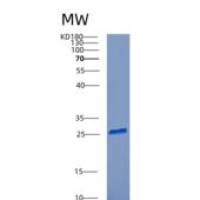 人柯萨奇病毒腺病毒受体(CXADR)重组蛋白