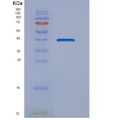 人DNAJB4重组蛋白