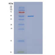 人DDX56重组蛋白