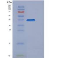 人细胞周期蛋白H(Cyclin H)重组蛋白