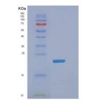 小鼠DHFR重组蛋白