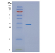 人DHRS4重组蛋白
