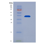 人趋化因子(C-X-C基序)配体3(CXCL3)重组蛋白