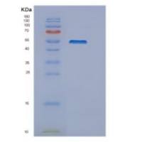 小鼠δ样蛋白4(Delta-like protein 4)重组蛋白