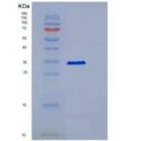 人脱氧胞苷激酶(DCK)重组蛋白