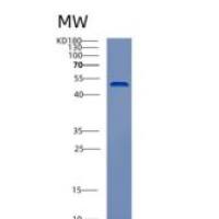 人酪蛋白激酶1δ(CSNK1d)重组蛋白