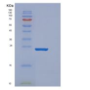 人密度调节蛋白(DENR)重组蛋白