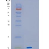 小鼠趋化因子（C-X-C基序）配体3(CXCL3)重组蛋白
