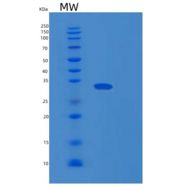 人DDAH1重组蛋白