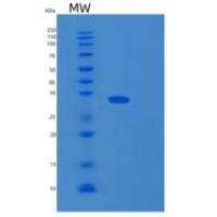 人DDAH1重组蛋白