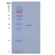 人DHRS4重组蛋白