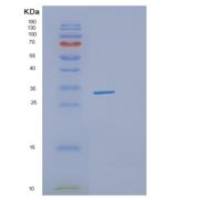 人DHRS4重组蛋白