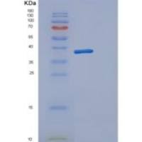 人DERA重组蛋白