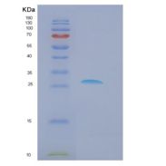人Dkk-1重组蛋白