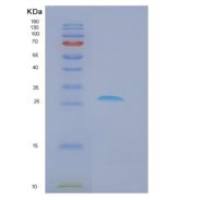 人Dkk-1重组蛋白