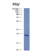 人CSRP2重组蛋白