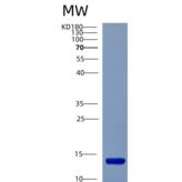 人半胱氨酸蛋白酶抑制剂A(CSTA)重组蛋白