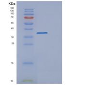 人DNA片段化因子亚基α(DFFa)重组蛋白