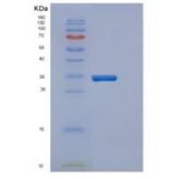 人CYB5R3重组蛋白