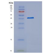 人细胞粘附素相互作用蛋白(CYTIP)重组蛋白