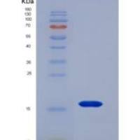 人B-淋巴细胞趋化因子(BLC)重组蛋白