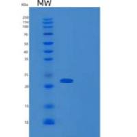 人动力素亚单位6(DCTN6)重组蛋白
