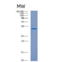 人组织蛋白酶L(CTSL)重组蛋白