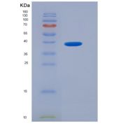 人趋化因子C-X3-C-基元配体1(CX3CL1)重组蛋白