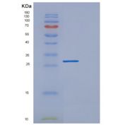 人DGCR6重组蛋白