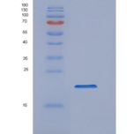 人亲环素A(Cyclophilin A)重组蛋白