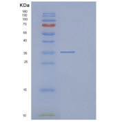 人DCUN1D4重组蛋白