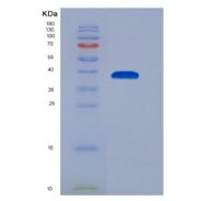 人趋化因子(C-X-C基序)配体3(CXCL3)重组蛋白