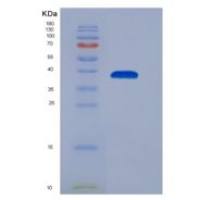 人趋化因子(C-X-C基序)配体3(CXCL3)重组蛋白