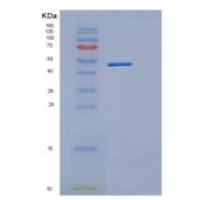 人细胞因子受体共同亚单位β蛋白重组蛋白