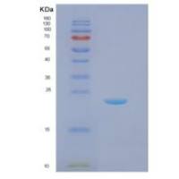 大肠杆菌二硫键异构酶重组蛋白